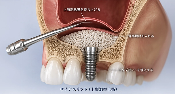 麻酔医による鎮静麻酔も可能