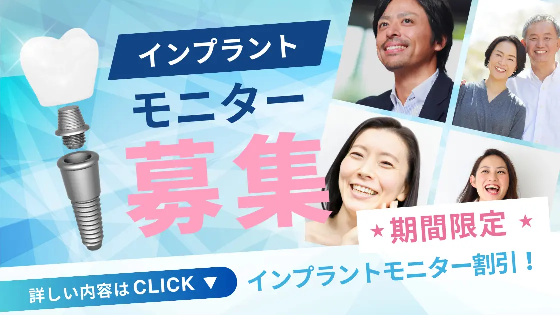 インプラントモニター募集